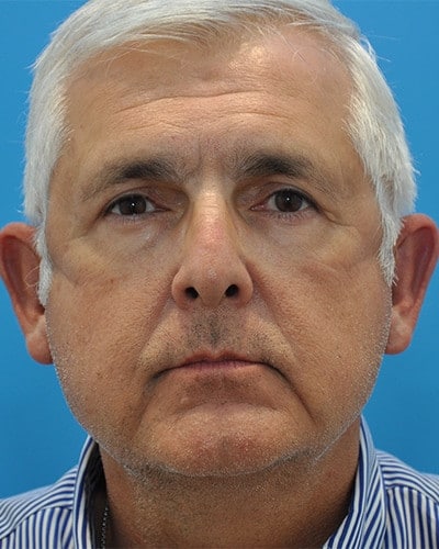 After Image