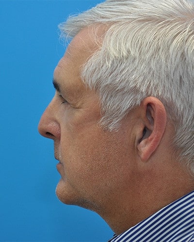 After Image