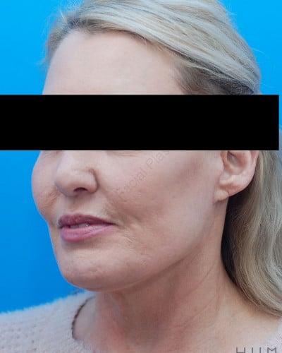 After Image