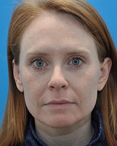 After Image