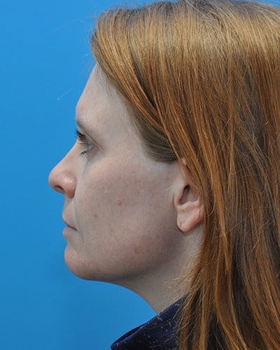 After Image