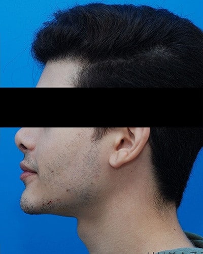 After Image