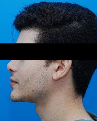 Before Image