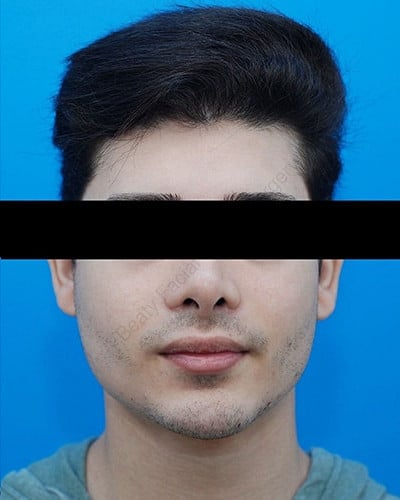 After Image