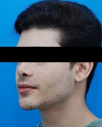 After Image