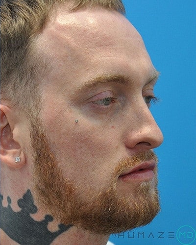 After Image