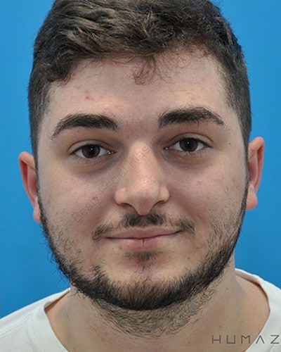 After Image