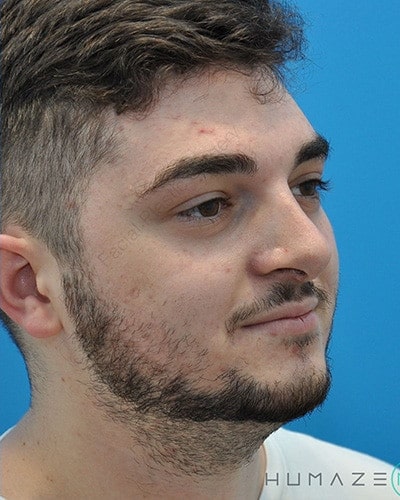 After Image