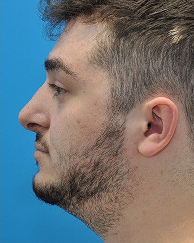 After Image