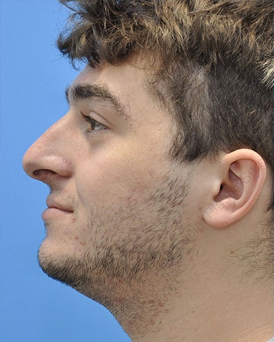 Before Image