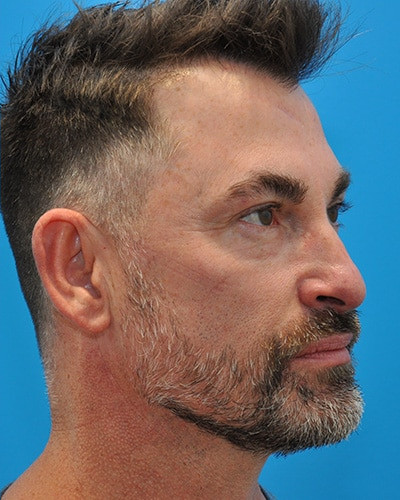 After Image