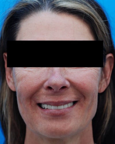After Image