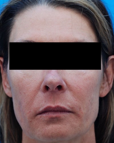 After Image