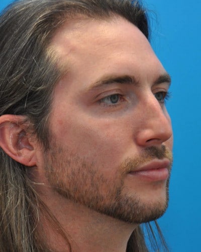 After Image