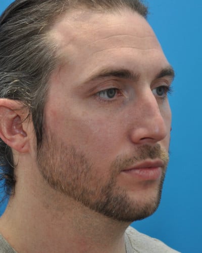 Before Image