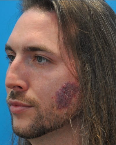 After Image