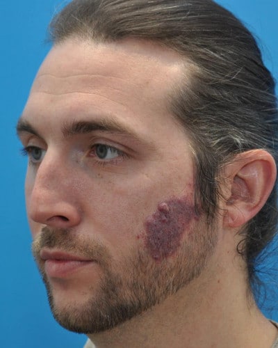 Before Image