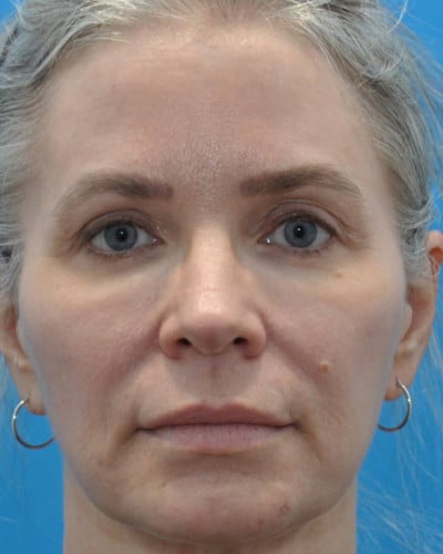 After Image