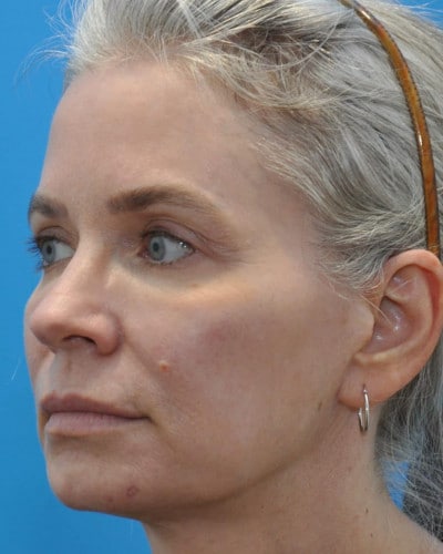 After Image