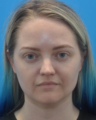 After Image