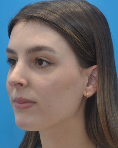 After Image