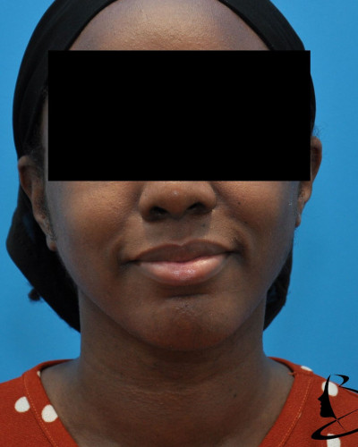 After Image
