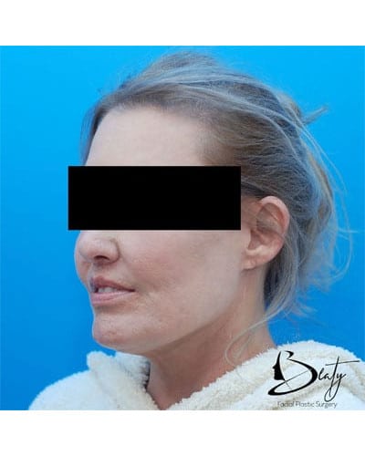After Image