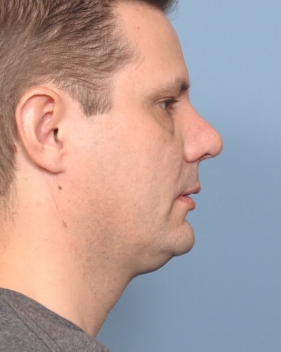 After Image