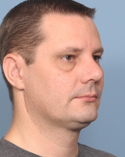 After Image