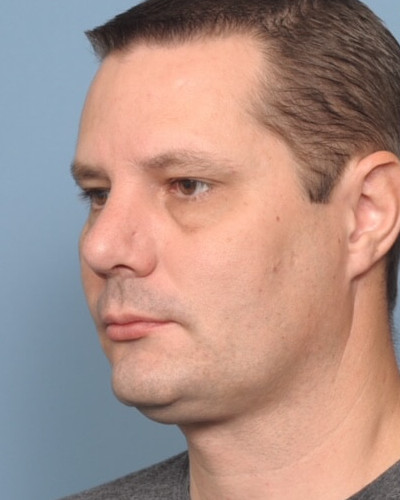 After Image