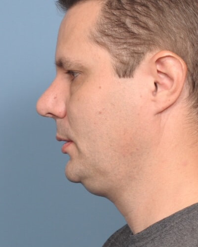After Image