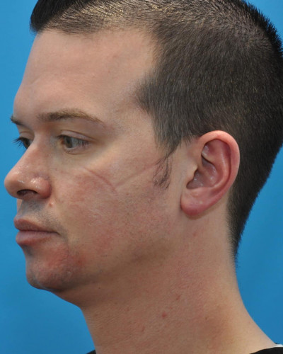 Before Image