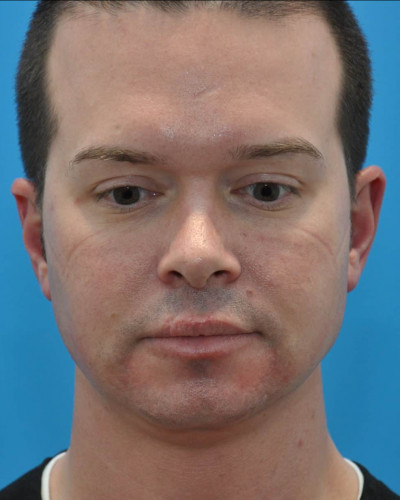 Before Image