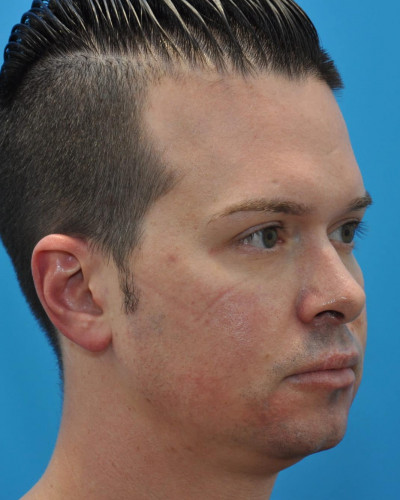 Before Image