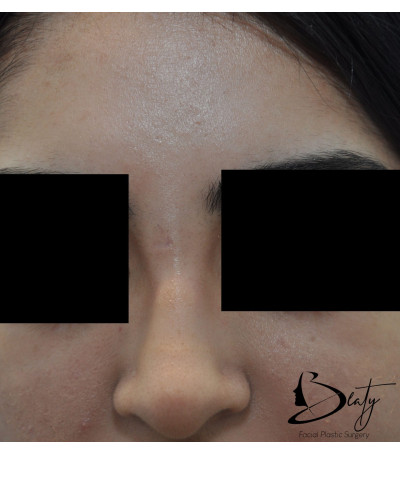 After Image