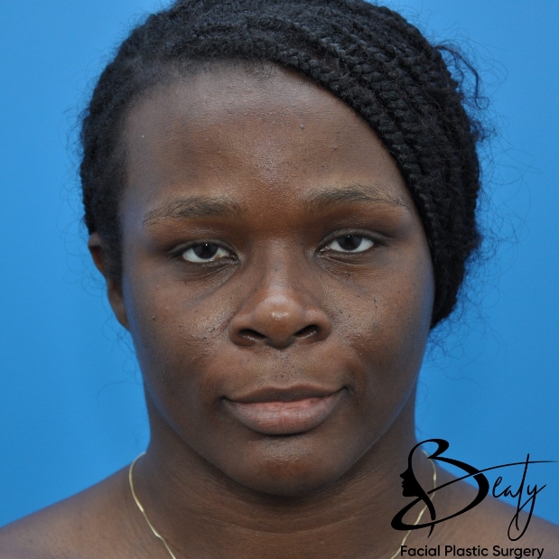 bna-sample
