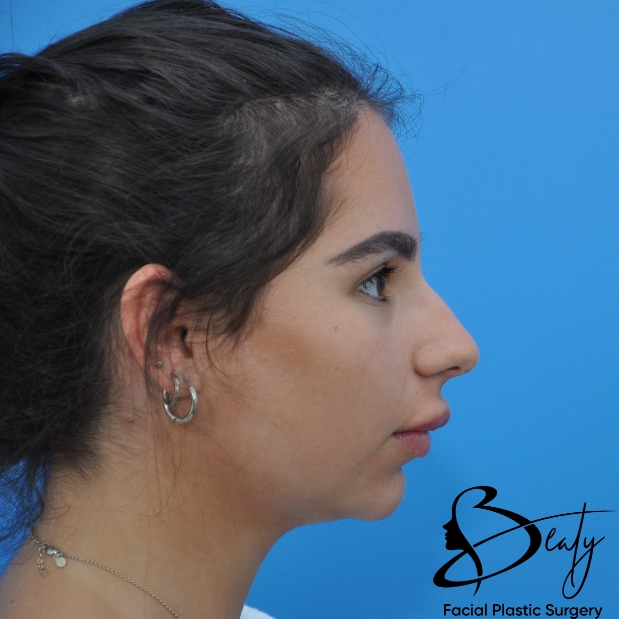 bna-sample