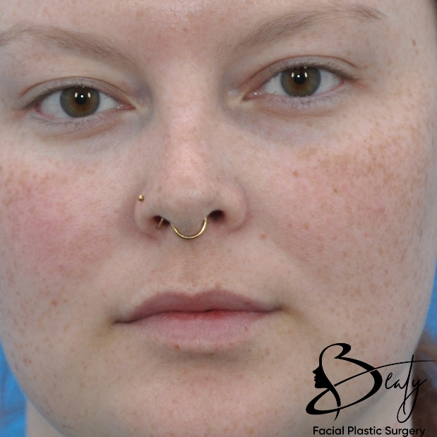 bna-sample
