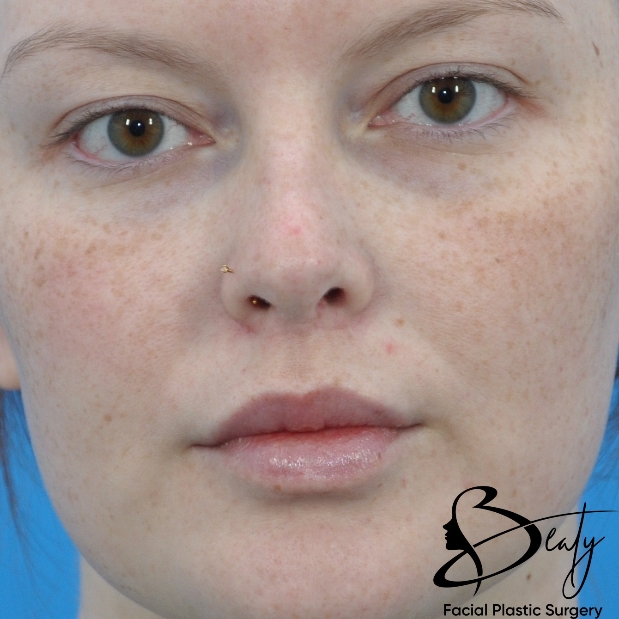 bna-sample