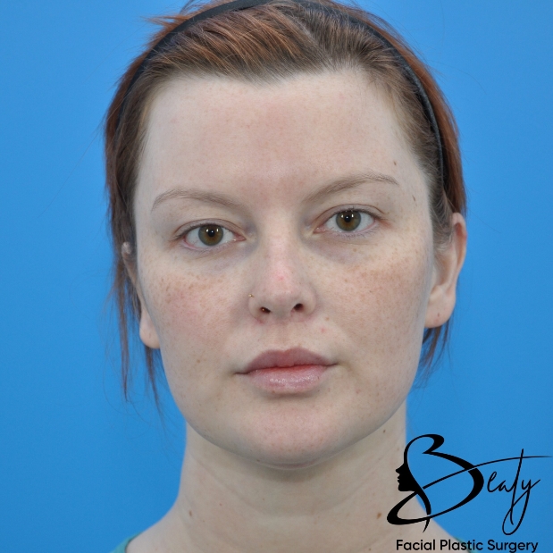 bna-sample