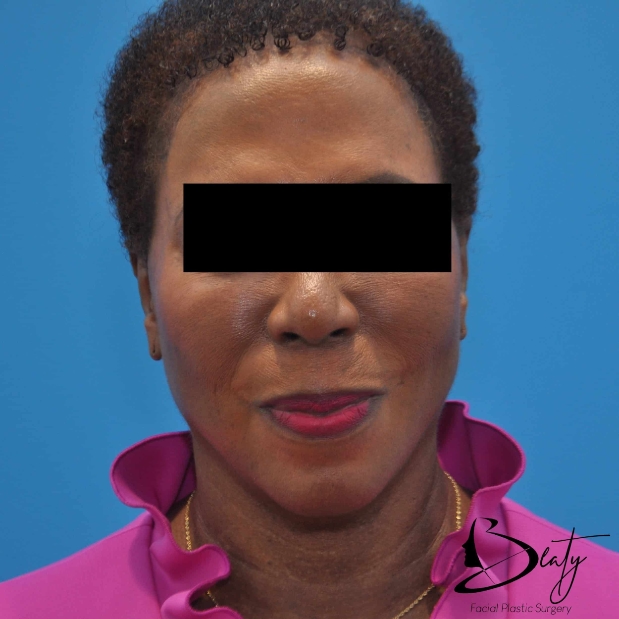 bna-sample