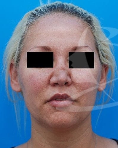 bna-sample